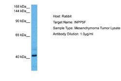 INPP5F Rabbit anti-Human, Polyclonal, Novus Biologicals 0.1ml; Unconjugated:Antibodies,